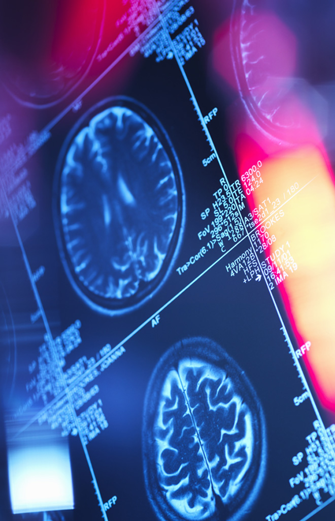 image of a brain scan